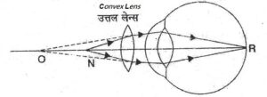Convex lens - ENI